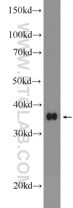 WB analysis of SH-SY5Y using 25622-1-AP