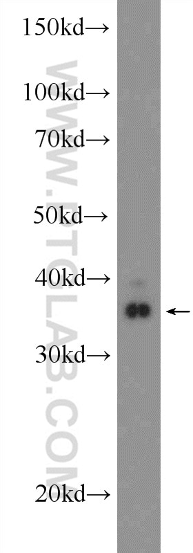 WB analysis of SH-SY5Y using 25622-1-AP