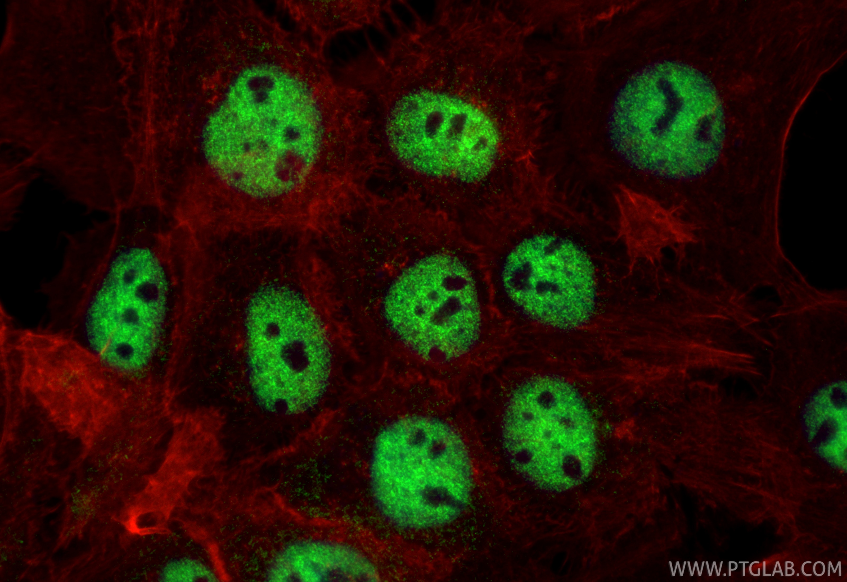 Immunofluorescence (IF) / fluorescent staining of A431 cells using BHLHE41 Polyclonal antibody (12688-1-AP)