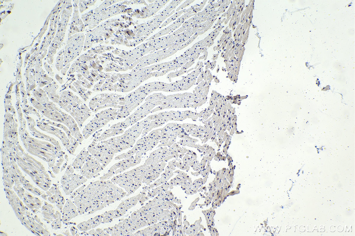 Immunohistochemistry (IHC) staining of rat heart tissue using BHLHE41 Polyclonal antibody (12688-1-AP)