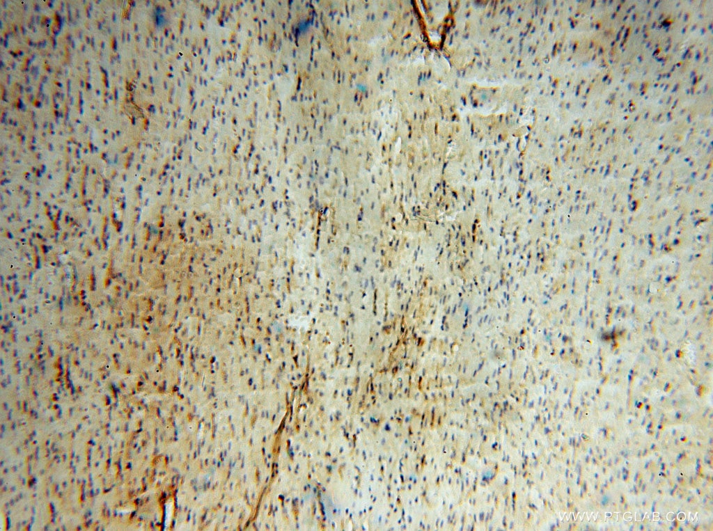 Immunohistochemistry (IHC) staining of human heart tissue using BHMT Polyclonal antibody (15965-1-AP)