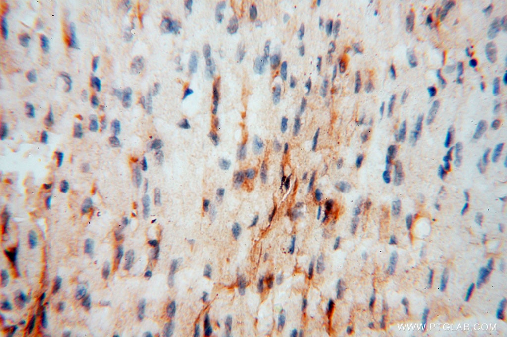 Immunohistochemistry (IHC) staining of human heart tissue using BHMT Polyclonal antibody (15965-1-AP)