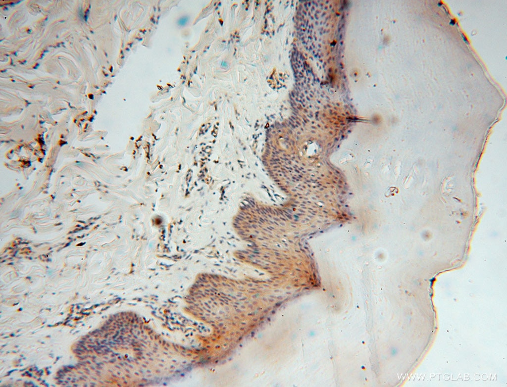 Immunohistochemistry (IHC) staining of human skin tissue using BHMT Polyclonal antibody (15965-1-AP)