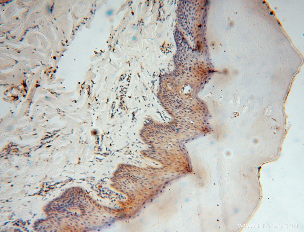 IHC staining of human skin using 15965-1-AP