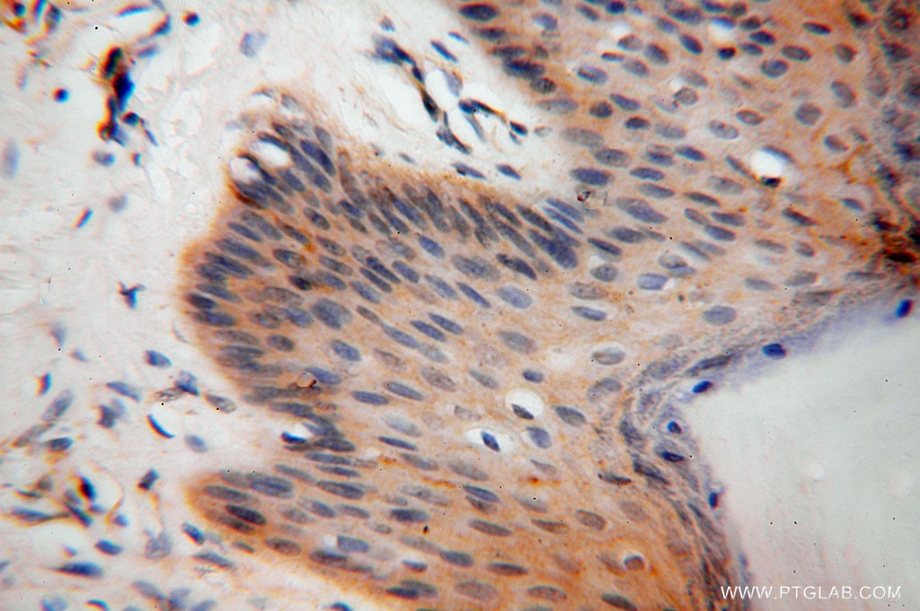 Immunohistochemistry (IHC) staining of human skin tissue using BHMT Polyclonal antibody (15965-1-AP)