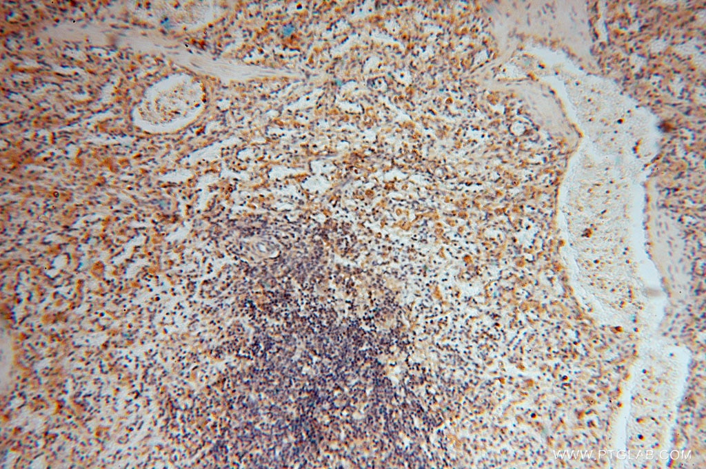 Immunohistochemistry (IHC) staining of human spleen tissue using BHMT Polyclonal antibody (15965-1-AP)
