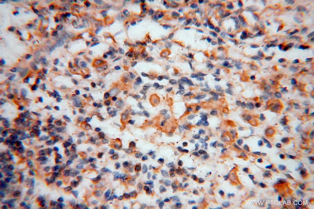 Immunohistochemistry (IHC) staining of human spleen tissue using BHMT Polyclonal antibody (15965-1-AP)