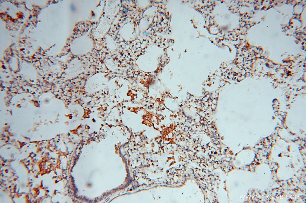 IHC staining of human lung using 15965-1-AP