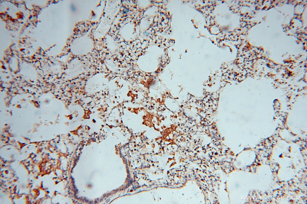 Immunohistochemistry (IHC) staining of human lung tissue using BHMT Polyclonal antibody (15965-1-AP)