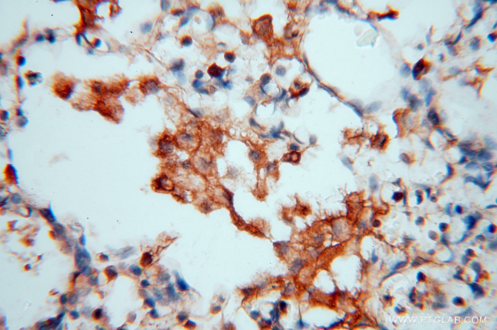 Immunohistochemistry (IHC) staining of human lung tissue using BHMT Polyclonal antibody (15965-1-AP)