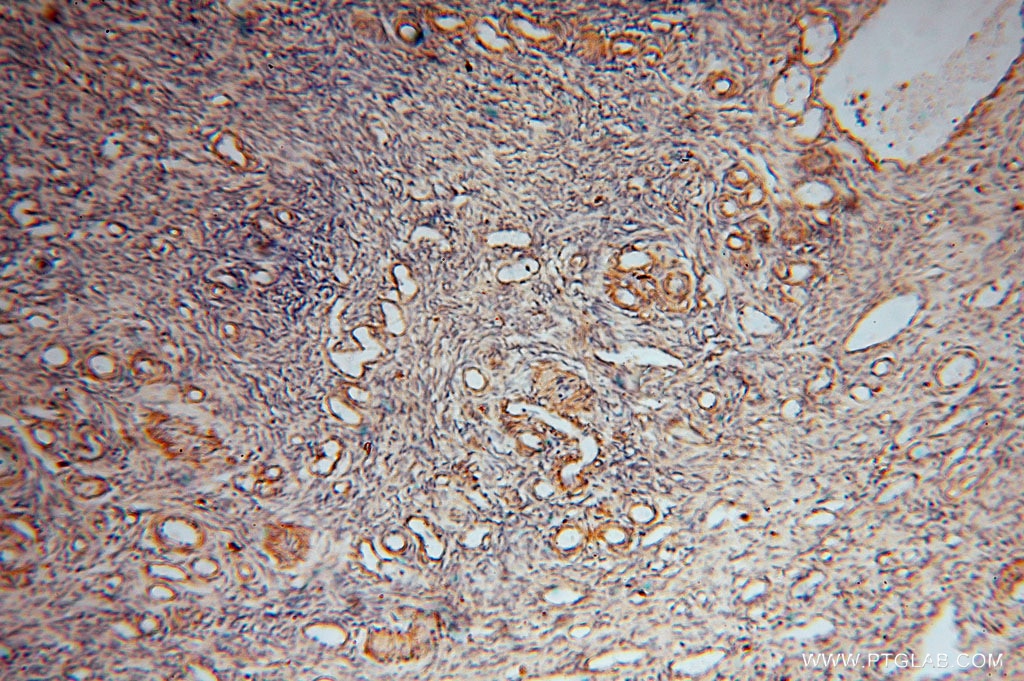 Immunohistochemistry (IHC) staining of human ovary tissue using BHMT Polyclonal antibody (15965-1-AP)