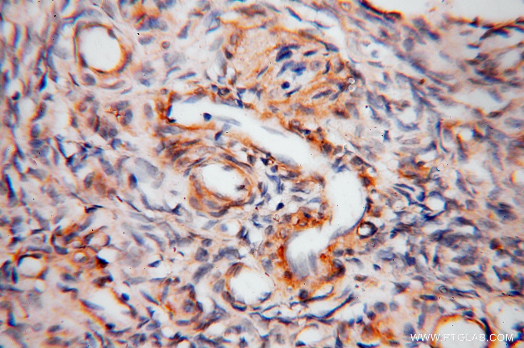 Immunohistochemistry (IHC) staining of human ovary tissue using BHMT Polyclonal antibody (15965-1-AP)