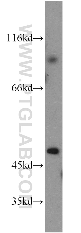 Western Blot (WB) analysis of L02 cells using BHMT Polyclonal antibody (15965-1-AP)