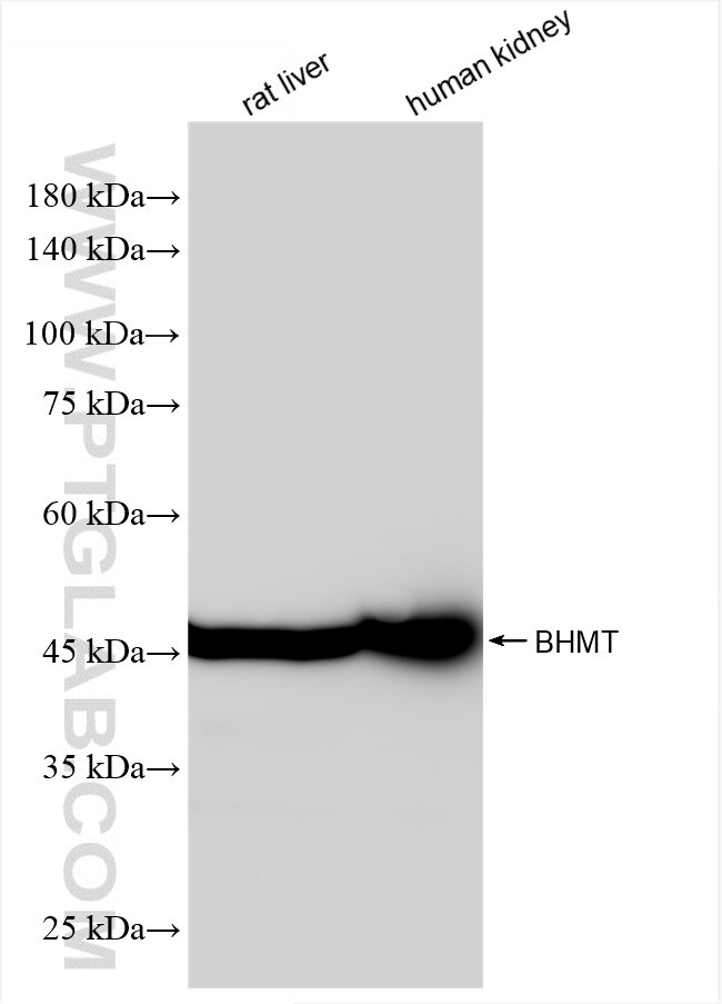 Western Blot (WB) analysis of various lysates using BHMT Recombinant antibody (86372-1-RR)