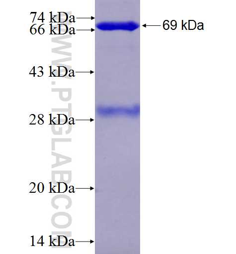 BHMT fusion protein Ag8738 SDS-PAGE