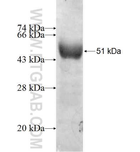 BHMT fusion protein Ag8965 SDS-PAGE