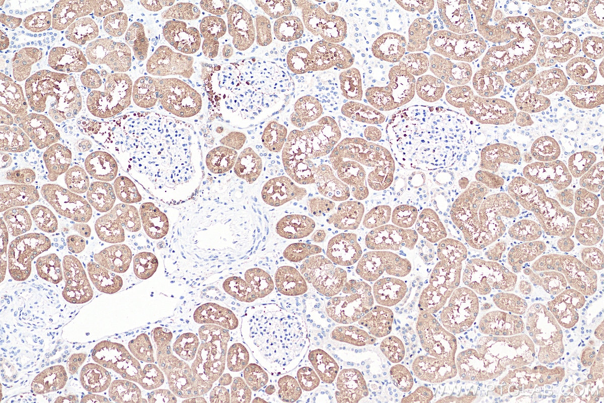Immunohistochemistry (IHC) staining of human kidney tissue using BHMT2 Polyclonal antibody (16351-1-AP)