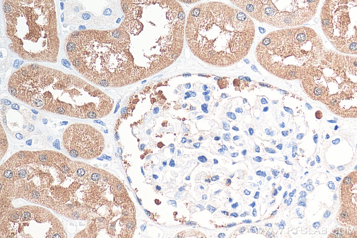 Immunohistochemistry (IHC) staining of human kidney tissue using BHMT2 Polyclonal antibody (16351-1-AP)
