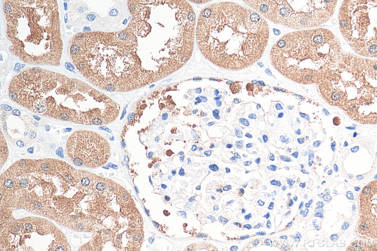 IHC staining of human kidney using 16351-1-AP