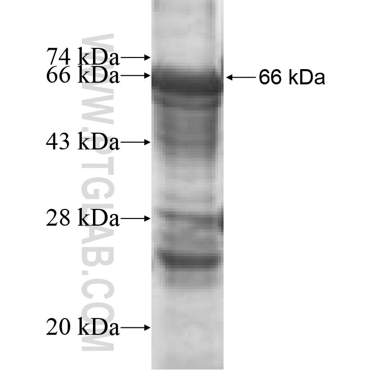 BHMT2 fusion protein Ag9558 SDS-PAGE