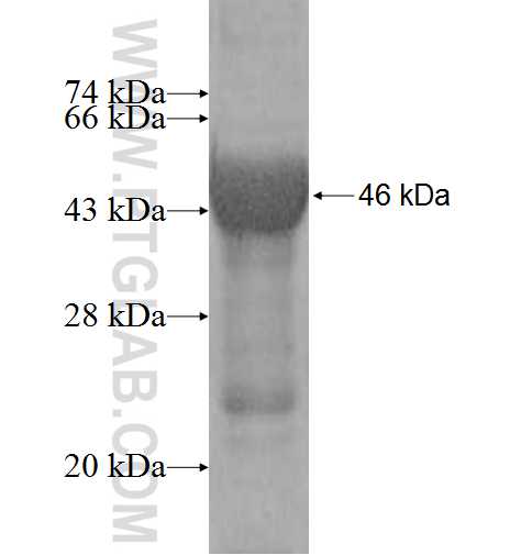 BHMT2 fusion protein Ag9875 SDS-PAGE