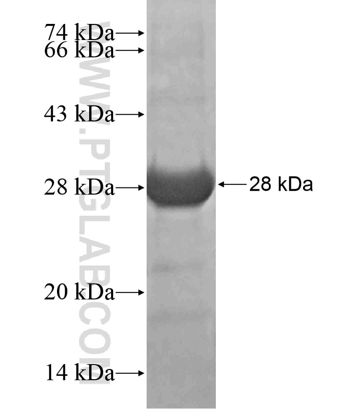 BICD1 fusion protein Ag17663 SDS-PAGE