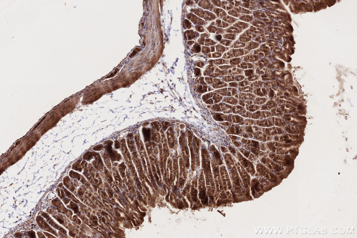 Immunohistochemistry (IHC) staining of mouse stomach tissue using BICD2 Polyclonal antibody (29603-1-AP)