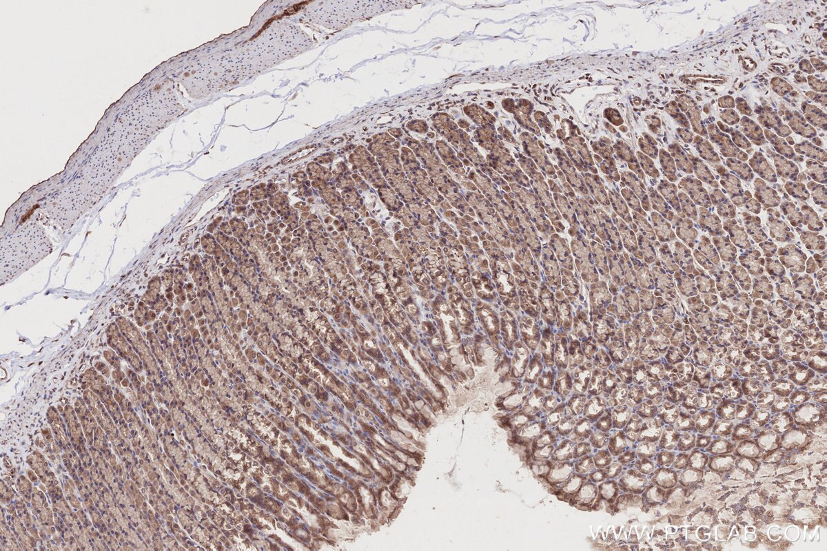Immunohistochemistry (IHC) staining of rat stomach tissue using BICD2 Polyclonal antibody (29603-1-AP)