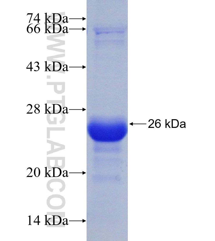 BICD2 fusion protein Ag31279 SDS-PAGE