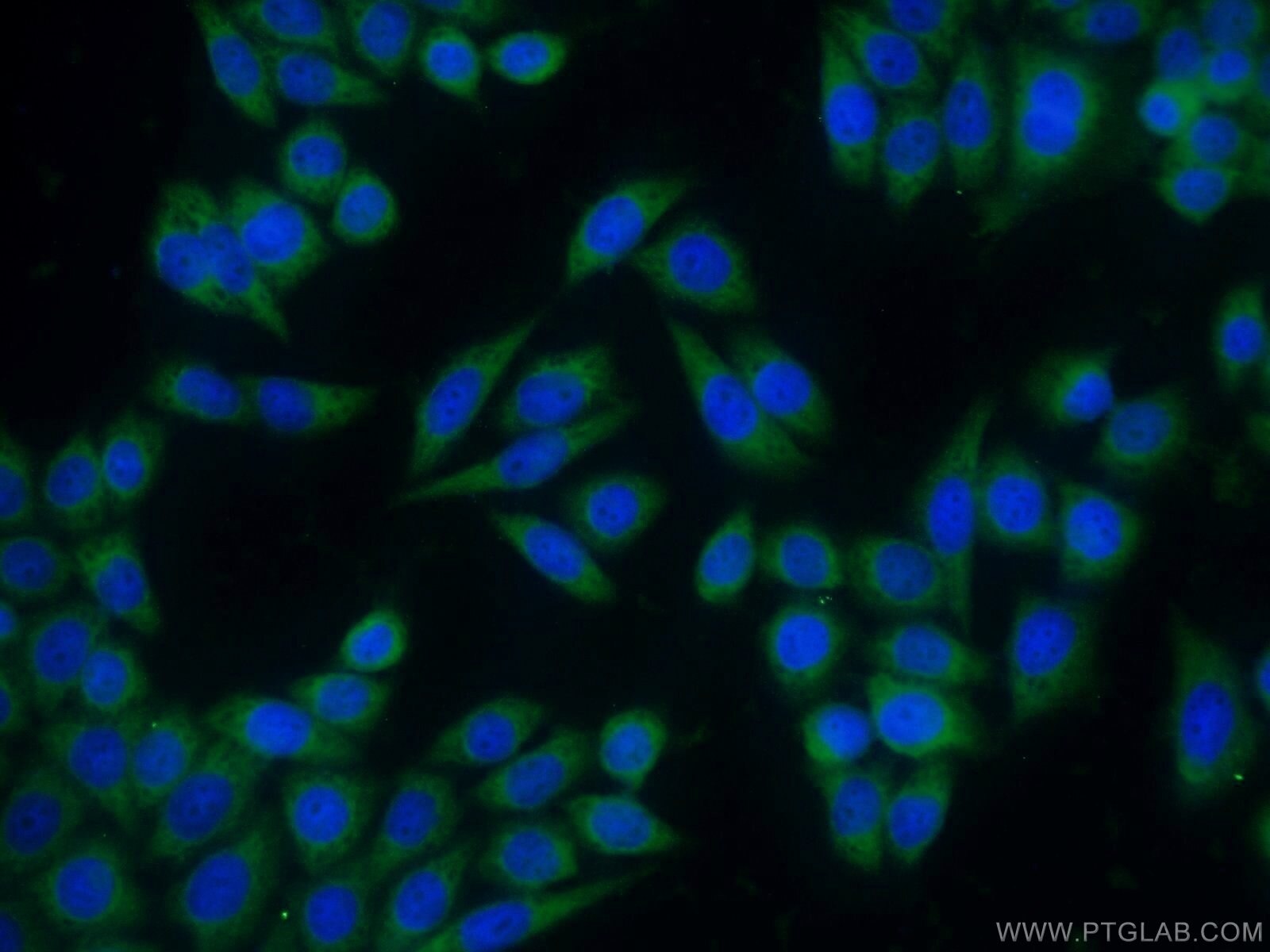 BID Polyclonal antibody