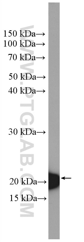 Western Blot (WB) analysis of A431 cells using BID Polyclonal antibody (10988-1-AP)