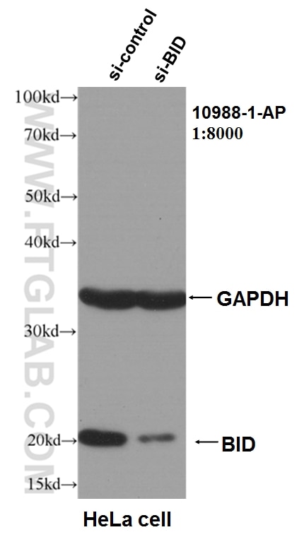 WB analysis of HeLa using 10988-1-AP