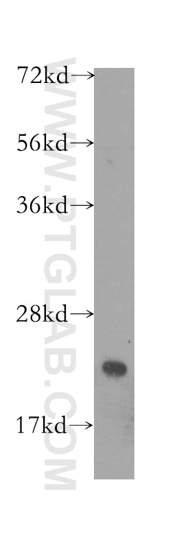 Western Blot (WB) analysis of human brain tissue using BID Polyclonal antibody (10988-1-AP)