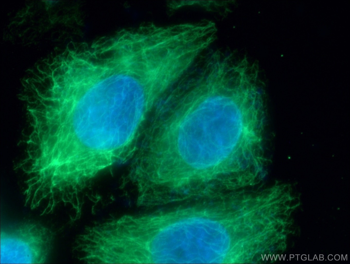 Immunofluorescence (IF) / fluorescent staining of HeLa cells using BID Monoclonal antibody (60301-1-Ig)