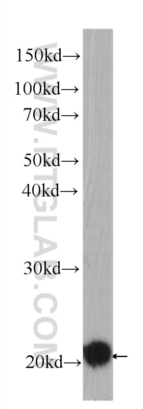 Western Blot (WB) analysis of HeLa cells using BID Monoclonal antibody (60301-1-Ig)