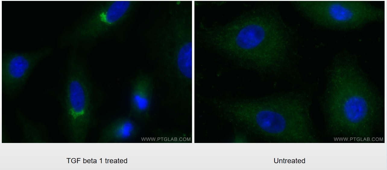 Immunofluorescence (IF) / fluorescent staining of A549 cells using TGFBI / BIGH3 Polyclonal antibody (10188-1-AP)