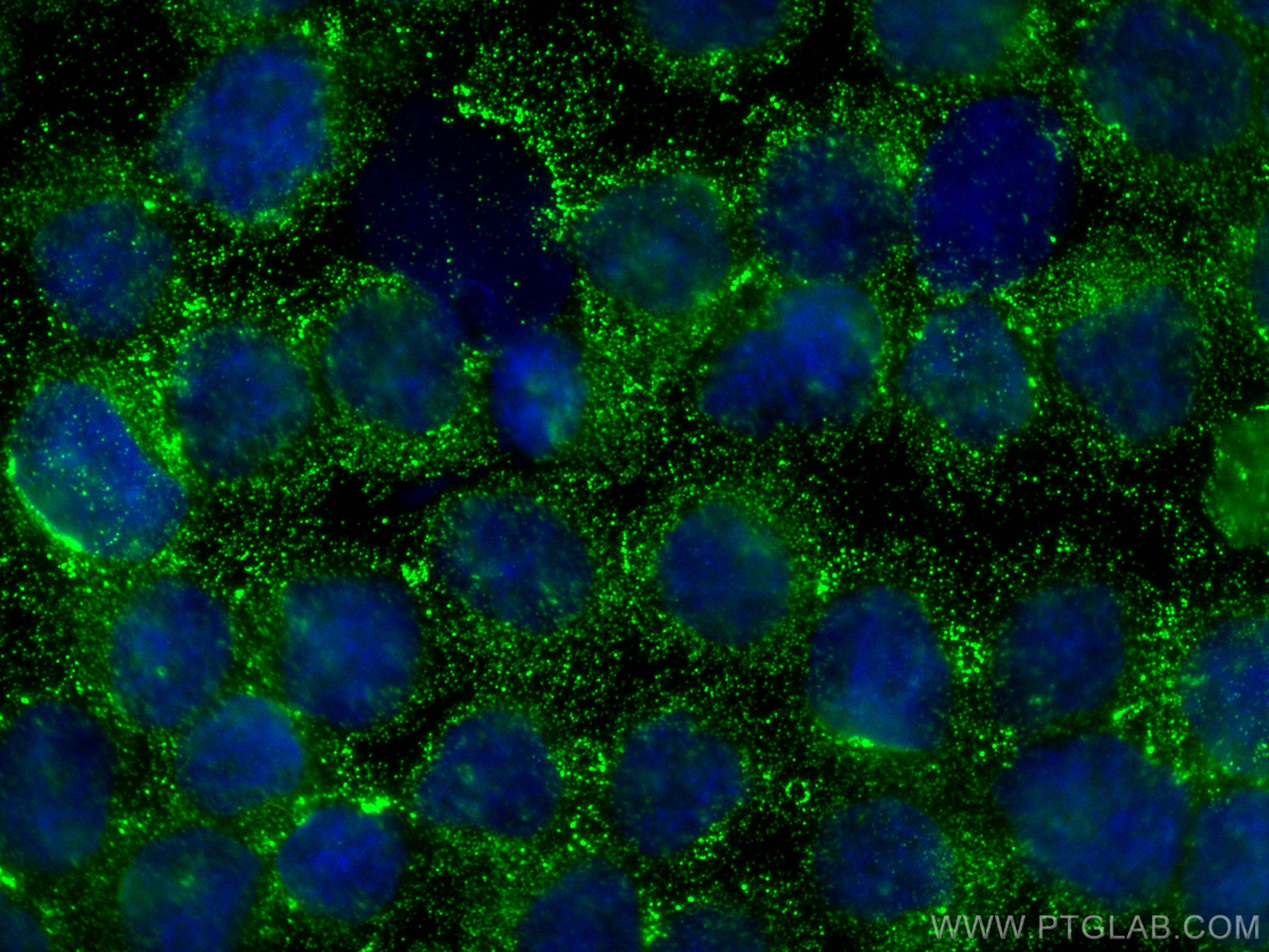 Immunofluorescence (IF) / fluorescent staining of Y79 cells using TGFBI / BIGH3 Polyclonal antibody (10188-1-AP)
