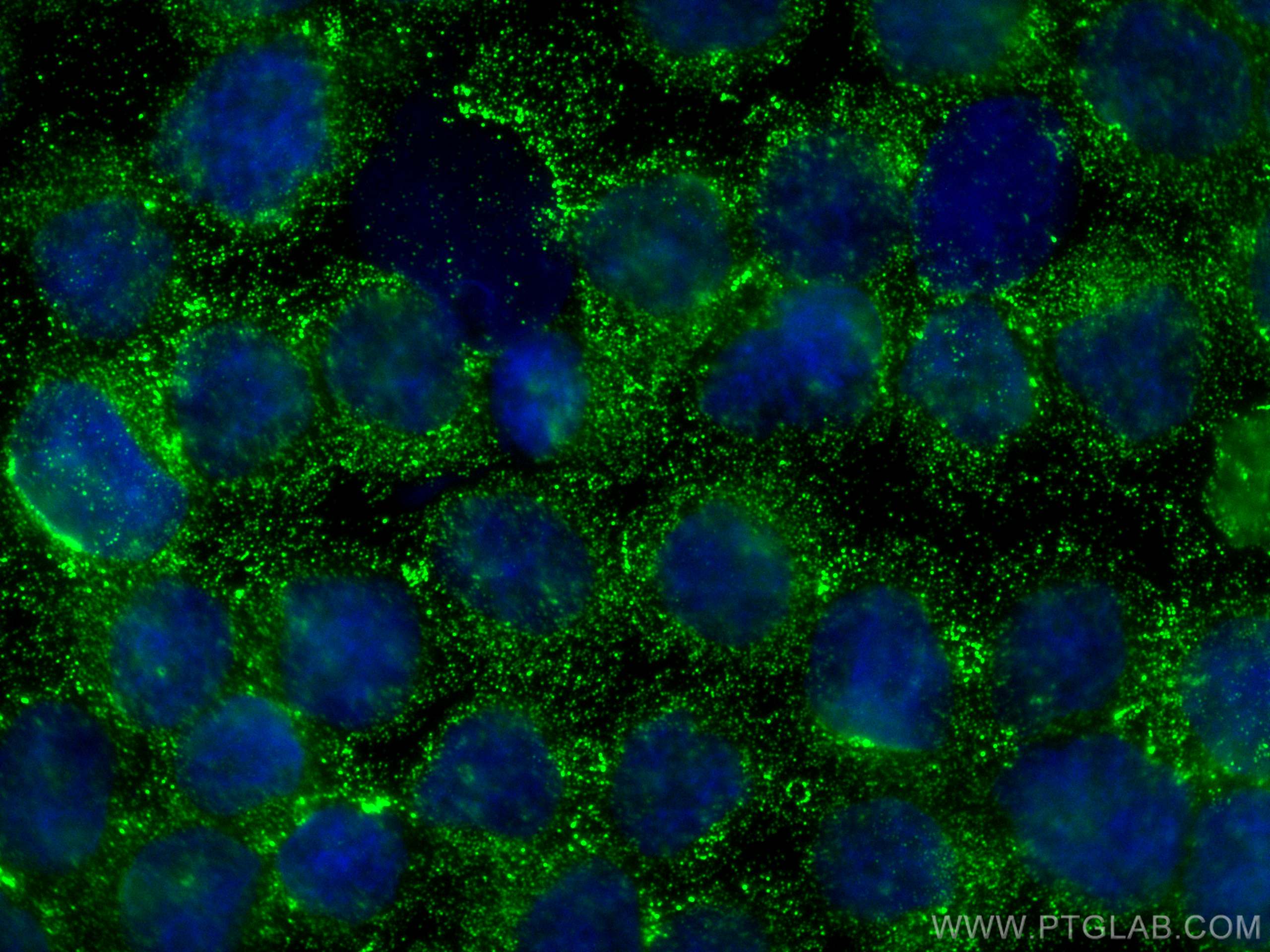 IF Staining of Y79 using 10188-1-AP