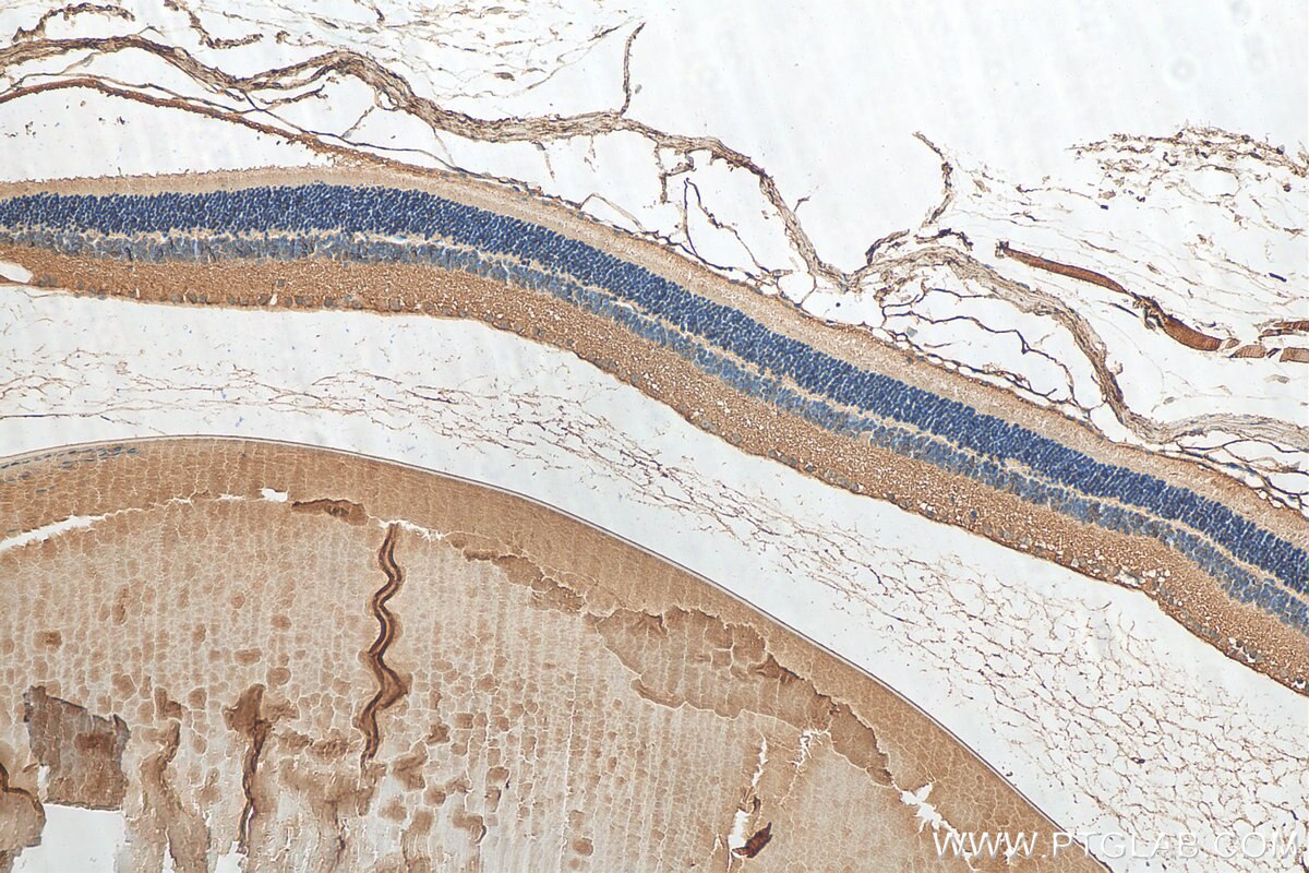 IHC staining of mouse eye using 10188-1-AP