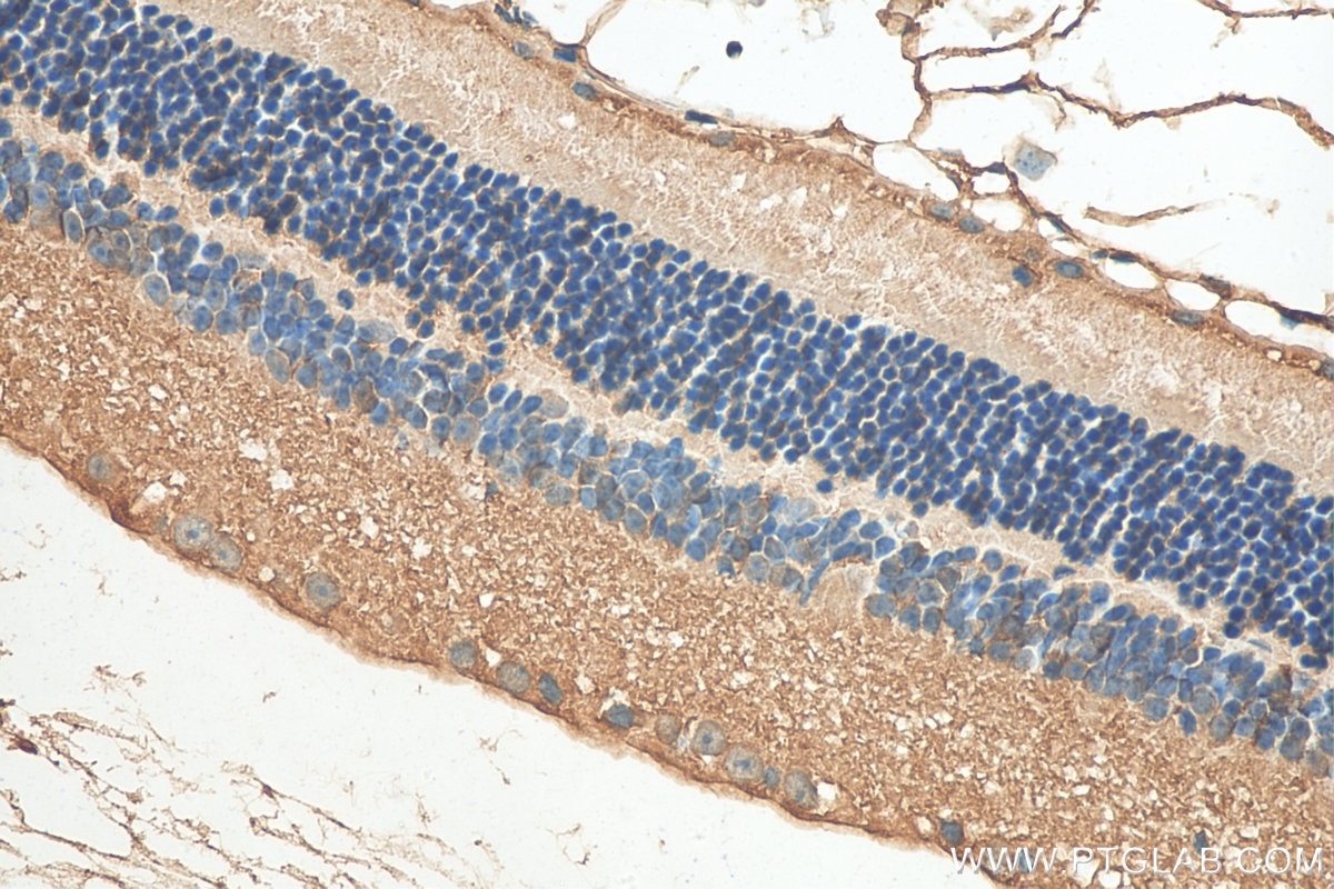 Immunohistochemistry (IHC) staining of mouse eye tissue using TGFBI / BIGH3 Polyclonal antibody (10188-1-AP)