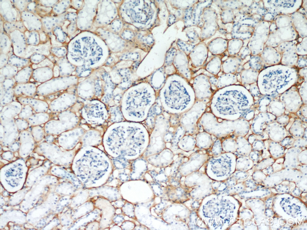 Immunohistochemistry (IHC) staining of human kidney tissue using TGFBI / BIGH3 Polyclonal antibody (10188-1-AP)