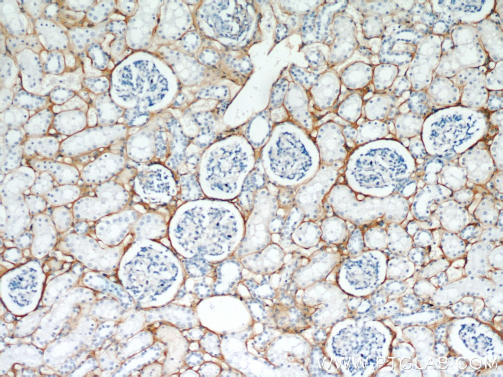 IHC staining of human kidney using 10188-1-AP