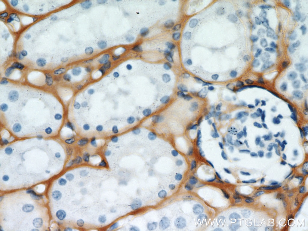 Immunohistochemistry (IHC) staining of human kidney tissue using TGFBI / BIGH3 Polyclonal antibody (10188-1-AP)