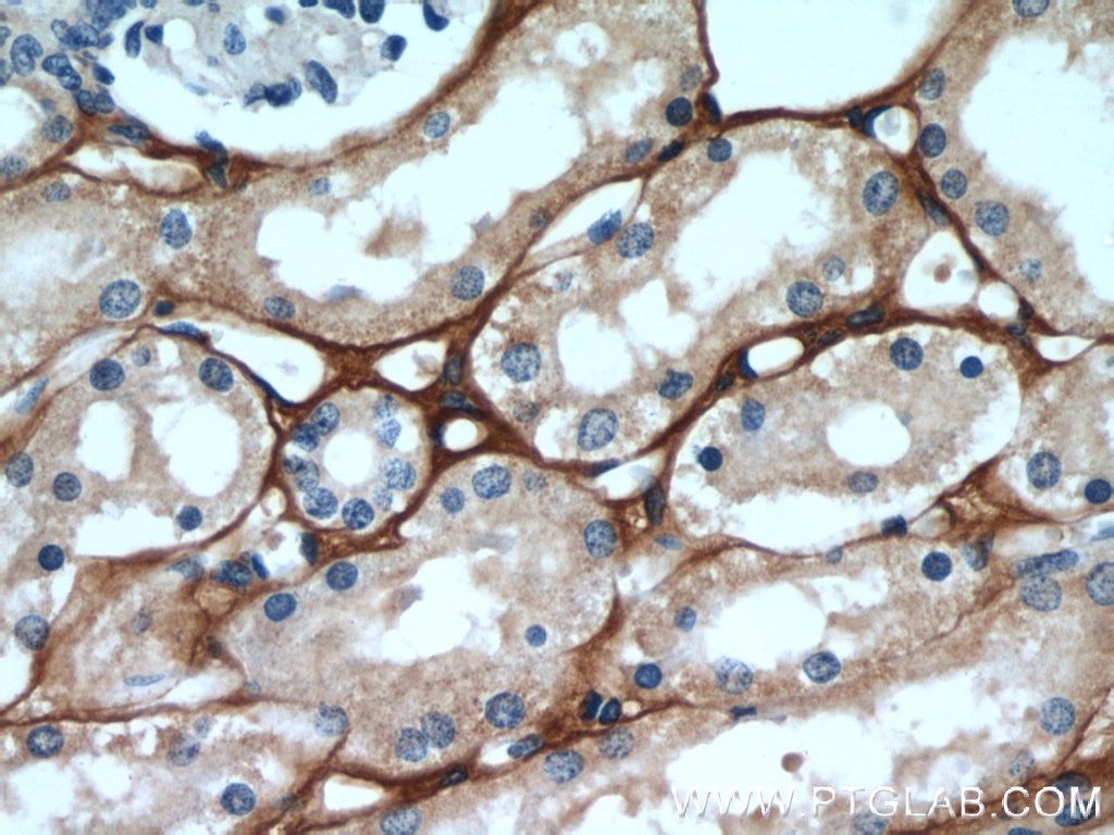 Immunohistochemistry (IHC) staining of human kidney tissue using TGFBI / BIGH3 Polyclonal antibody (10188-1-AP)