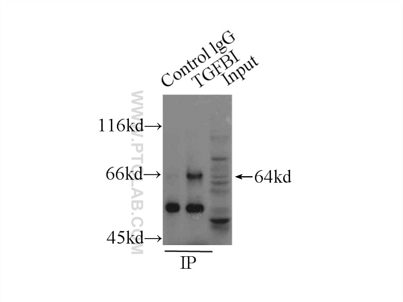 Immunoprecipitation (IP) experiment of HeLa cells using TGFBI / BIGH3 Polyclonal antibody (10188-1-AP)