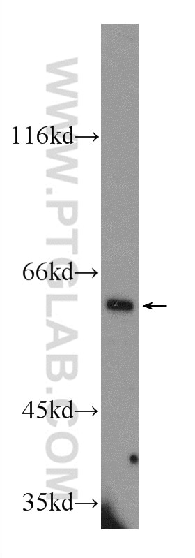 Western Blot (WB) analysis of Y79 cells using TGFBI / BIGH3 Polyclonal antibody (10188-1-AP)