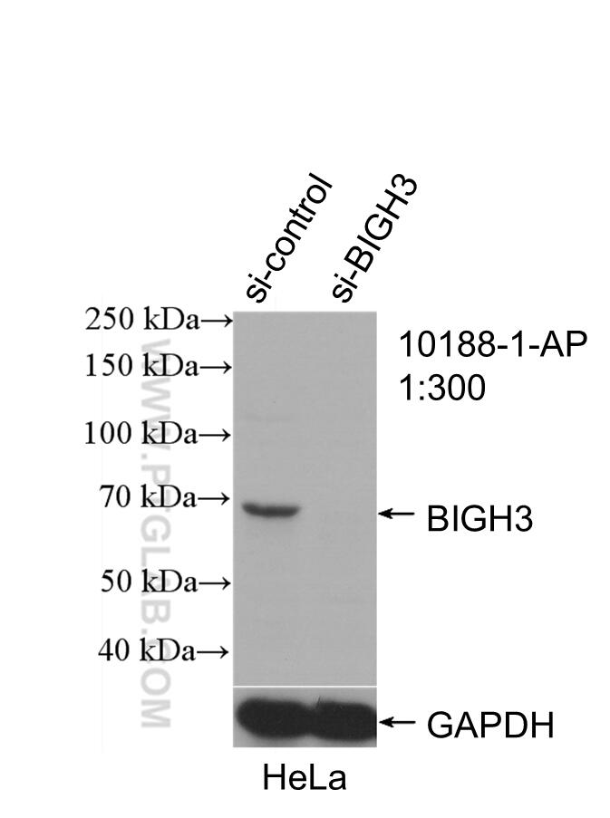 Western Blot (WB) analysis of HeLa cells using TGFBI / BIGH3 Polyclonal antibody (10188-1-AP)