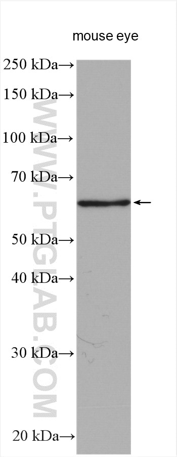 Western Blot (WB) analysis of various lysates using TGFBI / BIGH3 Polyclonal antibody (10188-1-AP)