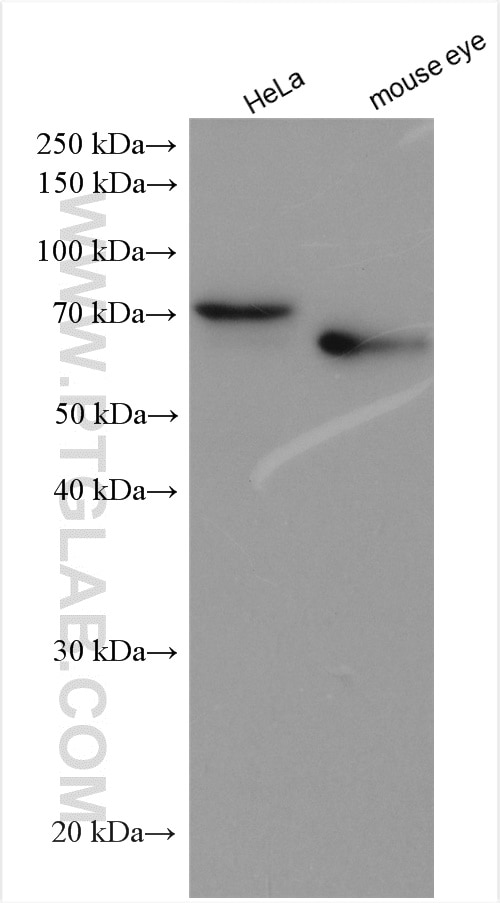 Western Blot (WB) analysis of various lysates using TGFBI / BIGH3 Polyclonal antibody (10188-1-AP)