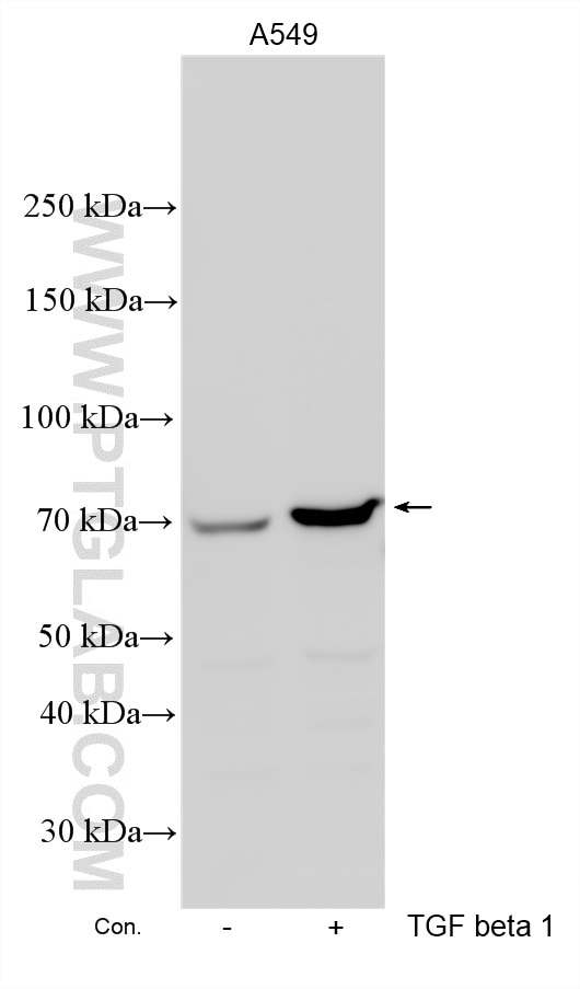 Western Blot (WB) analysis of various lysates using TGFBI/BIGH3 Polyclonal antibody (10188-1-AP)